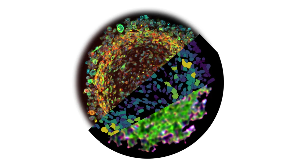 Three-panel scientific imaging of a space-grown glioblastoma organoid: immunofluorescence, gene expression map and chemical imaging.